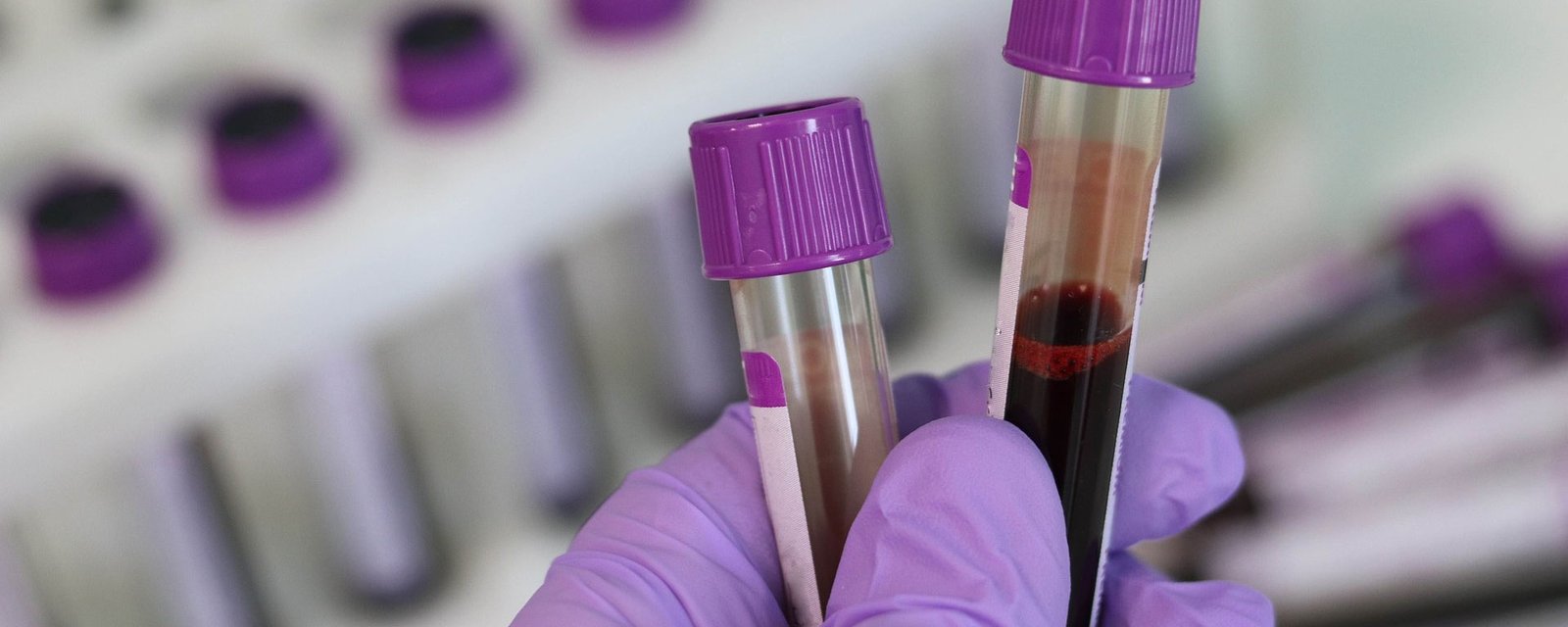 Curso de Extraccionista